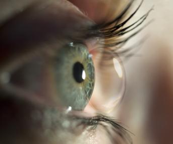 Kontaktlinse auf dem Auge 